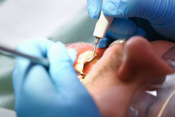 Best Emergency Treatment for Toothache in Alton, IL