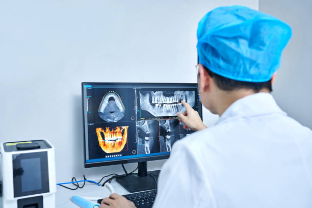 Best Emergency Root Canal Treatment in Alton, IL