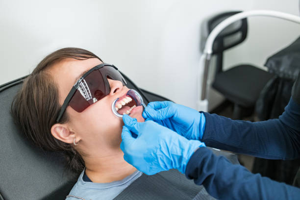 Best Emergency Wisdom Teeth Removal in Alton, IL